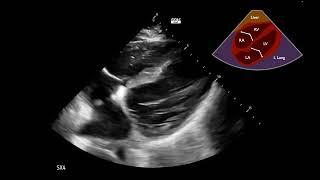 Cardiogenic Shock Case 2:  Part 1 - Interpretation Challenge