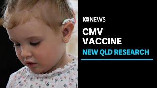 Queensland researchers develop experimental vaccine against cytomegalovirus | ABC News