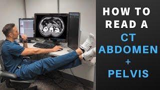 Radiology:  How to Read a CT Abdomen & Pelvis (My search pattern)