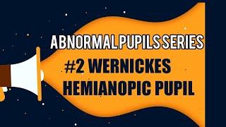 WERNICKE'S HEMIANOPIC PUPIL || Abnormal pupillary reaction series #2