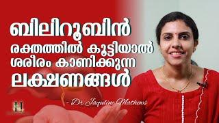 Bilirubin | ബിലിറൂബിൻ കൂടിയാൽ ശരീരം കാണിക്കുന്ന ലക്ഷണങ്ങൾ | Dr Jaquline Mathews BAMS