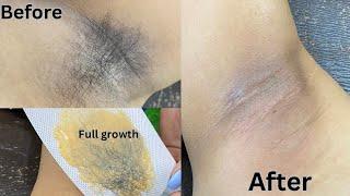 Fully growth underarm waxing || Full Tutorial vedio  Rica Wax  ⬆️