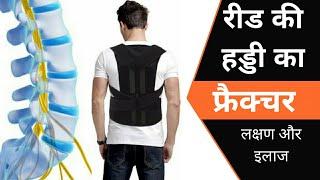 रीड की हड्डी का फ्रैक्चर लक्षण एवं इलाज  Spine Fracture Symptoms and Treatment स्पाइन फ्रैक्चर  इलाज