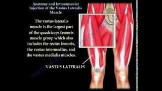 Vastus Lateralis intramuscular Injection - Everything You Need To Know - Dr. Nabil Ebraheim
