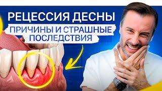 Неочевидная причина рецессии десны. Что делать, если опустилась десна?