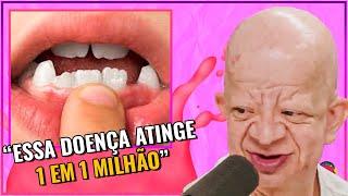 A CONDIÇÃO GENÉTICA DE BRUNO DIFERENTE