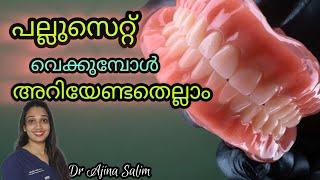 ഊരി മാറ്റാവുന്ന കൃത്രിമ പല്ല് വെക്കുമ്പോൾ അറിയേണ്ടത് | veppu pallu | Artificial teeth വെക്കുമ്പോൾ