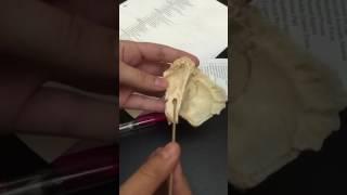 Temporal Bone - Valle Anatomy 32