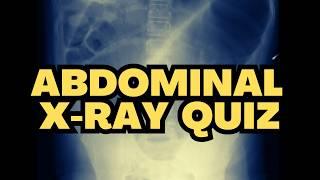 Abdominal X-ray Quiz