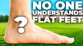 How To Fix Flat Feet (the real way)