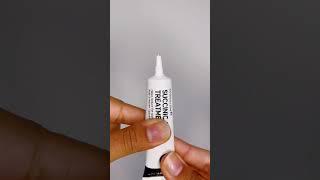The Inkey List Succinic acid treatment| Skincare unboxing| aesthetic inkey list unboxing