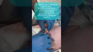 ВСЕМ РОДИТЕЛЯМ НОВОРОЖДЕННЫХ СМОТРЕТЬ ОБЯЗАТЕЛЬНО! ОСМОТР МЛАДЕНЦА ДЕТСКИМ УРОЛОГОМ #shorts #уролог