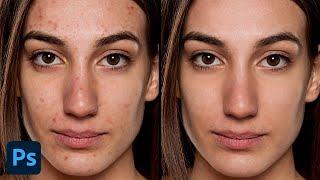 Photoshop Tutorial - Quickly Remove Blemishes and Pimples