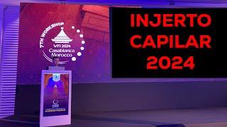 INJERTO CAPILAR actualización 2024 [Congreso Medico WFI 2024]