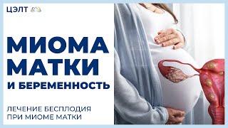  Миома матки и беременность. Лечение бесплодия при миоме матки. ЦЭЛТ.