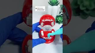 Dental ASMR Getting Braces | Melissa & Doug Dentist Kit #Shorts