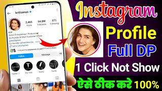 instagram profile zoom not working Problem || How to zoom not working instagram DP