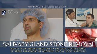 Airline Pilot has a Transoral Salivary Gland Stone Surgery