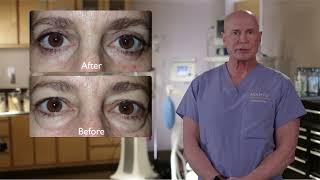 Dr. Niamtu Discusses Cosmetic Blepharoplasty (eyelid surgery)