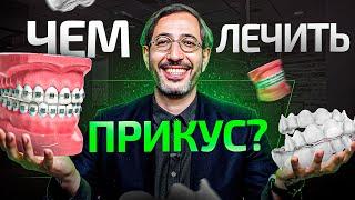 Как лечить неправильный прикус. Все способы простыми словами в 1 видео