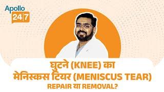 Apollo24|7घुटने के मेनिस्कस की मरम्मत क्यों है ज़रूरी? | Meniscus Tear | Apollo 24|7