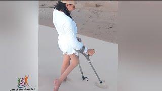 The beautiful woman has polio, the challenge of disability #polio_woman