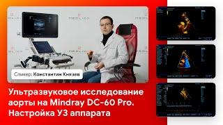 Ультразвуковое исследование аорты на Mindray DC-60 Pro. Настройка УЗИ аппарата