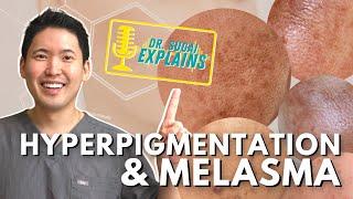 Dermatologist Explains: Hyperpigmentation and Melasma - How to Manage it with Top Picks