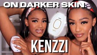 HOME LASER HAIR REMOVER DEMO & REVIEW: Kenzzi on darker skin. Is it safe?