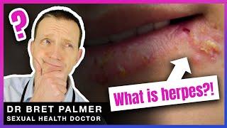 Everything you didn't want to know about herpes but have been forced to find out!