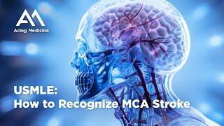 USMLE: How to Recognize MCA Stroke | Acing Medicine