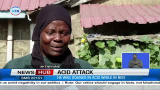 52-year-old man dies after being doused in acid by his wife