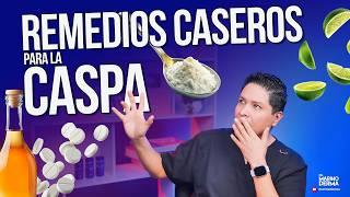 REMEDIOS CASEROS PARA CASPA || Consejos de un dermatólogo