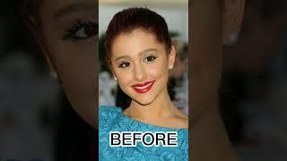 ARIANA GRANDE BEFORE AFTER- SHORTS