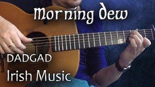 Morning Dew - Irish Guitar - DADGAD Fingerstyle Reel