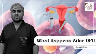 What happens after OPU | Care IVF Ovum Pick-Up Ovum Pick-Up process EmbryoTransfer fertilityjourney