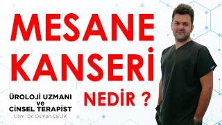 MESANE KANSERİ Nedir? | Kanserin belirtileri ve tedavileri