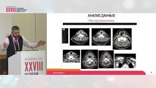 Выбор объемов мишеней лучевой терапии и органов риска наиболее сложной локализации: ОГШ