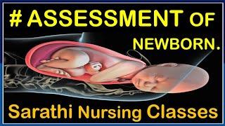 Assessment Of Newborn | Neonatal Assessment | Neurological Assessment By Balwant Nagar Amli #newborn