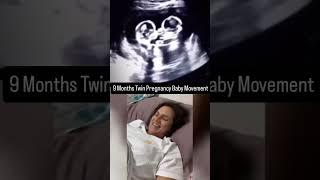 9 Months Twin Pregnancy Baby Movement