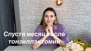 Трудности после тонзиллэктомии. Спустя месяц после операции.