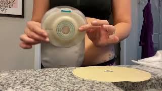 Ostomy Bag Change | How to | sensitive skin