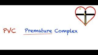 Premature Ventricular Contractions (PVC) Interpretation: Easy and Simple!