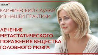 Метастатическое поражение ствола головного мозга. Лечение