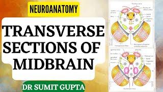 Transverse Sections of Midbrain || NEUROANATOMY-THE BRAINSTEM