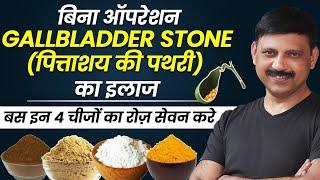 बिना ऑपरेशन Gallbladder Stone (पित्ताशय की पथरी) का अचूक इलाज | Manas Samarth