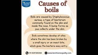 Boils#boils#drkukrejakalani#kenthomeopathyclinic#8291492566#hiranandanipowai#mumbai#videoconsult