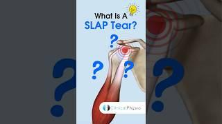 SLAP Tear #physicaltherapy #physiotherapy #shoulder #anatomy