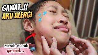 Gawat!!! Aqilla Alergi - Mbak Kunyit Ikutan Panik | Aqilla's Diary