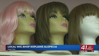 Macon wig shop explains Alopecia